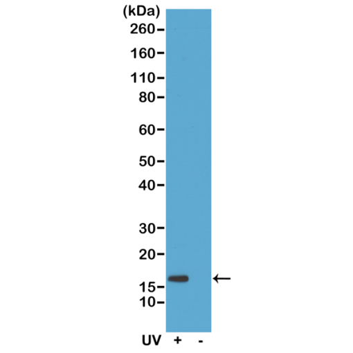 Anti-Gamma H2AX (phospho-Ser139), Rabbit Monoclonal (RM224)