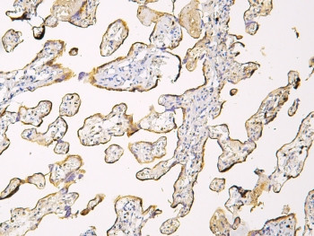 Anti-Haptoglobin