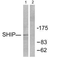 Anti-INPP5D