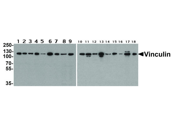 Anti-Vinculin, clone [7E10]