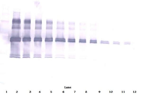 Anti-IL12 (p35 + p40)