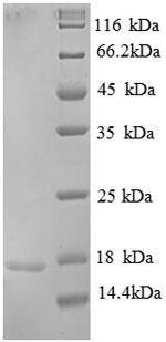 Replication protein A 14KDA subunit (RPA3), partial, human, recombinant