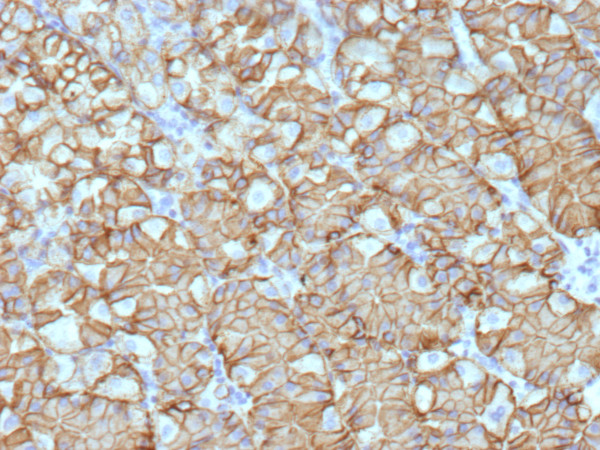 Anti-Renal Cell Carcinoma (Carbonic Anhydrase IX), recombinant antibody, clone CA9/9621R