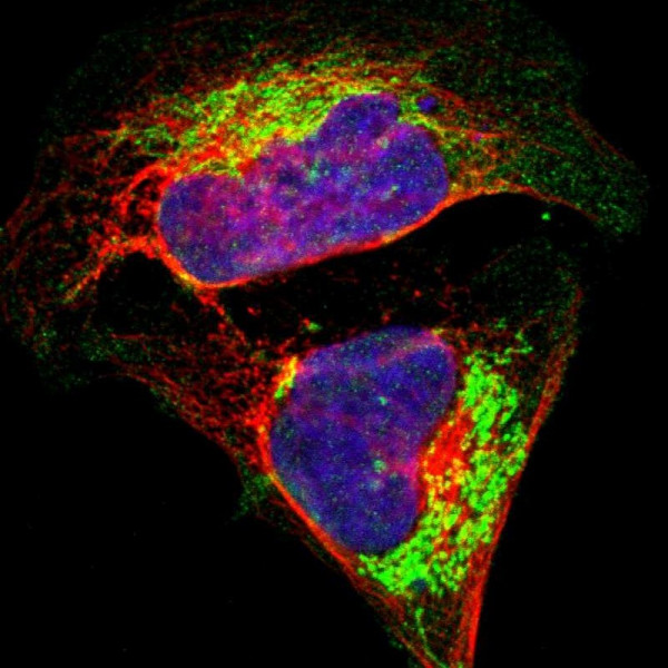 Anti-ATP5B