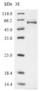 Transcriptional enhancer factor TEF-1 (TEAD1), partial, human, recombinant