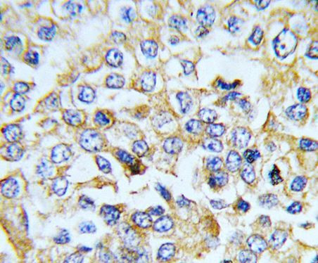 Anti-Natriuretic Peptide Receptor A