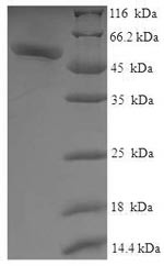 Galactose mutarotase (GALM), human, recombinant