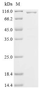 Glycoprotein (G), partial, Biotinylated, recombinant Rabies virus