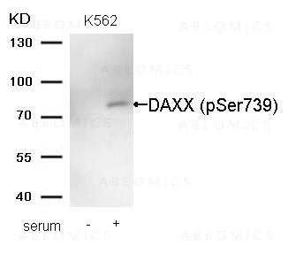 Anti-phospho-DAXX (Ser739)
