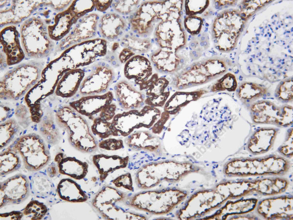 Anti-Recombinant V ATPase B1, clone C112563