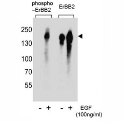 Anti-HER2 (ERBB2) (phospho-Y1005)