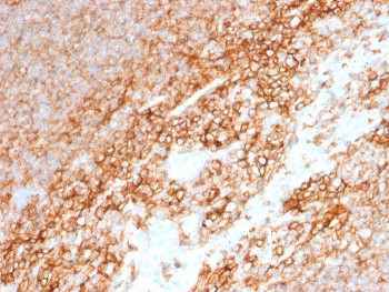 Anti-CD44 / HCAM, clone BU75
