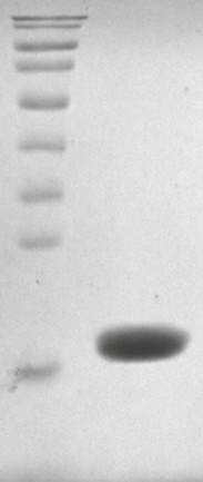 Recombinant Human UbE2D3