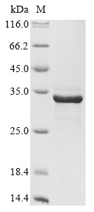 Deoxyribonuclease gamma (DNASE1L3), human, recombinant