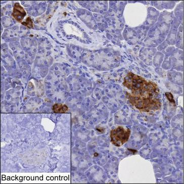 Anti-PCSK1