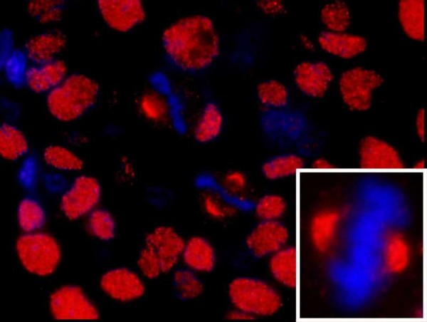Anti-NUMA (IHC)