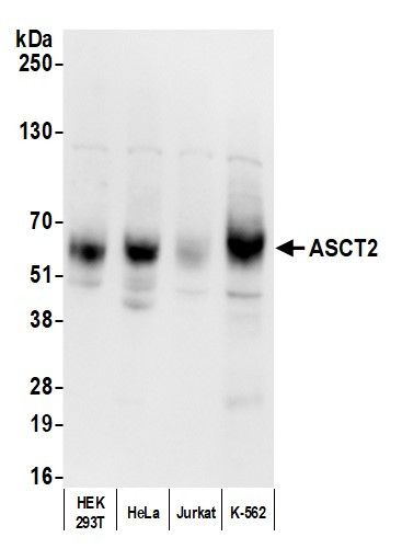 Anti-ASCT2