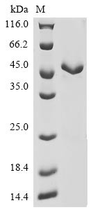 Actin, aortic smooth muscle (ACTA2), human, recombinant
