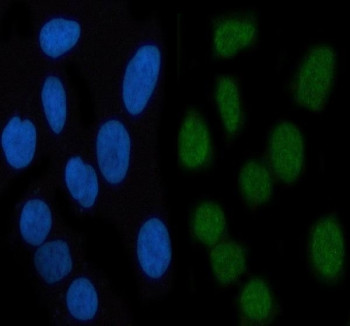 Anti-phospho-STAT3 (Ser727), clone CAA-19