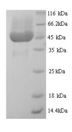 Attachment protein G3P (III), Enterobacteria phage M13, recombinant