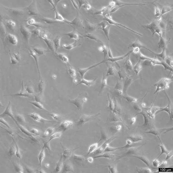 MC3T3-E1 Subclone 14 Cells