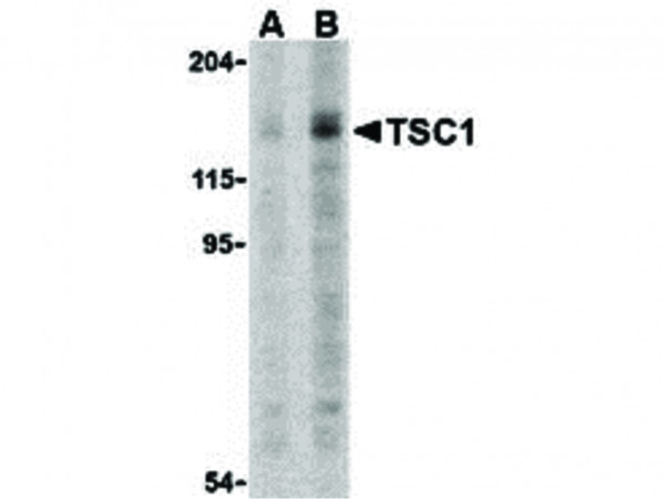 Anti-TSC1