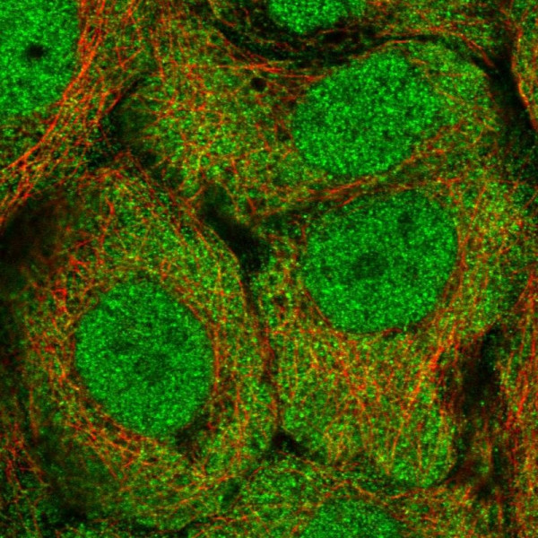 Anti-ALDH1A3