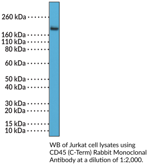 Anti-CD45 (C-Term), clone RM291