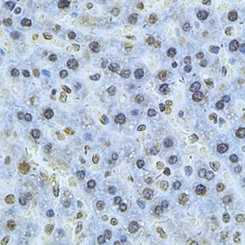 Anti-PSMC3 / TBP1