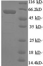 Synapsin-1 (SYN1), partial, human, recombinant