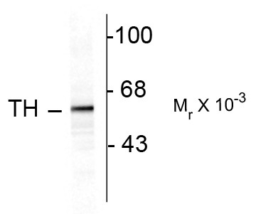 Anti-Tyrosine Hydroxylase