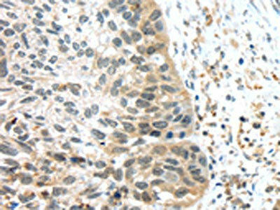 Anti-TSPY1/TSPY3