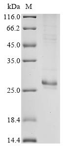 Protein I (N), Bovine coronavirus, recombinant