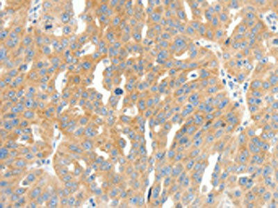 Anti-COL4A1