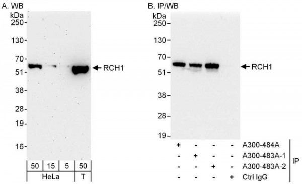 Anti-RCH1/KPNA2