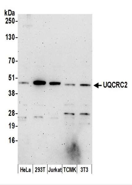 Anti-UQCRC2