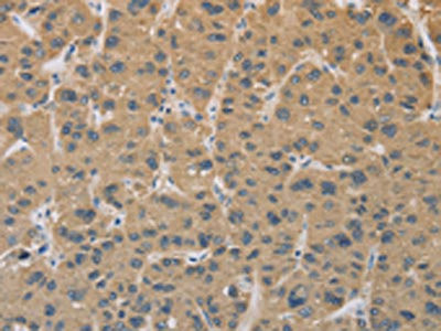 Anti-CYFIP2