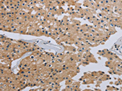 Anti-HSD3B7
