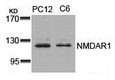 Anti-NMDAR1 (Ab-896)