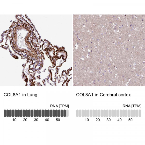 Anti-COL8A1