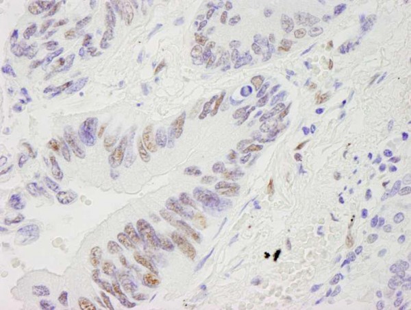 Anti-RecQ1 (IHC)