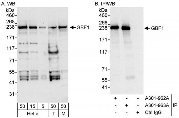 Anti-GBF1