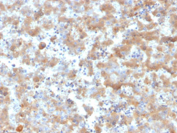 Anti-Alpha-2-Macroglobulin, clone A2M/6555