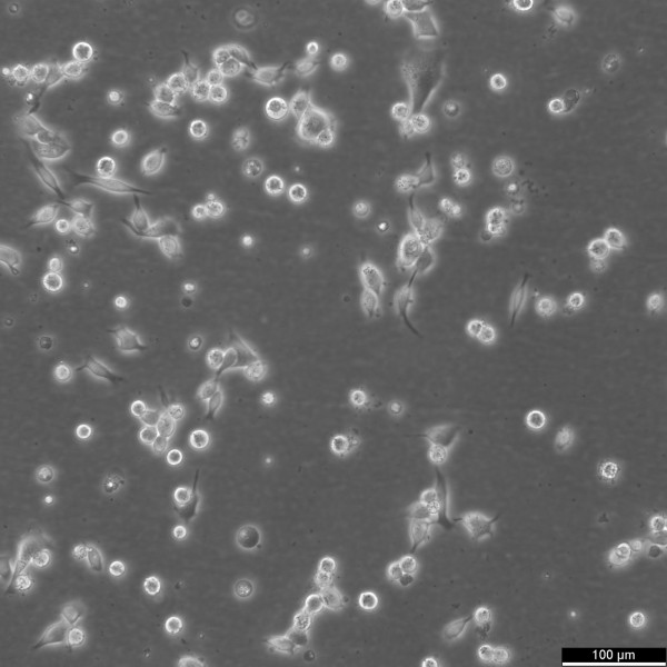 EBC-1 Cells