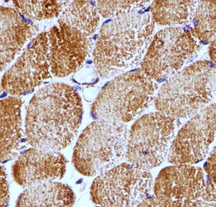 Anti-Raptor, clone 1411CT316.2.151.34