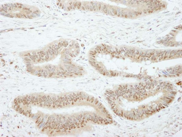Anti-SSH3 IHC Antibody, affinity purifie (IHC)