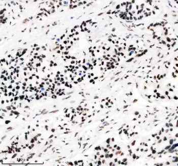 Anti-PABPN1 / Polyadenylate-binding protein 2, clone AAHI-16