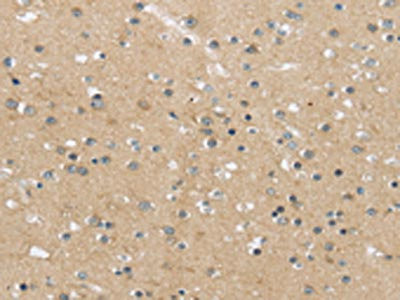 Anti-MPP6