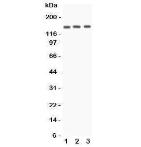 Anti-Angiotensin Converting Enzyme (ACE)