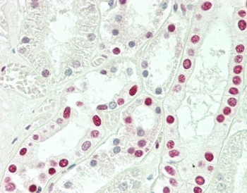Anti-SNRPD3 / Sm-D3